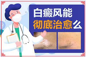 东莞哪家医院治疗白癜风有名