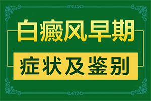 东莞有哪几家正规治疗白癜风的医院