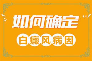 东莞治疗白癜风医院哪家较强