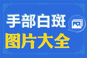东莞比较好的治疗白癜风医院