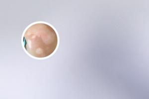 甲泼尼龙片的说明书用法用量