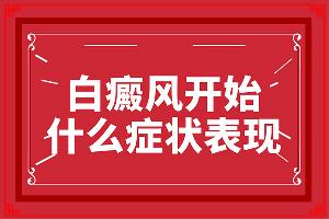 东莞哪家医院治疗白癜风较好好