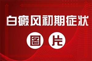 兰州安宁区治疗白癜风的专业有哪些
