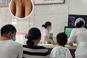 白颠疯什么症状