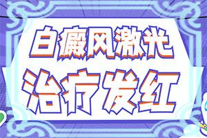 东莞到哪家医院治白癜风能