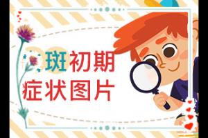 东莞白癜风医治到哪家医院好
