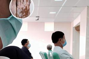 白谷子泡药治白癫风