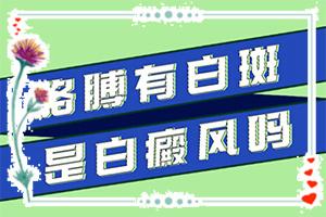 东莞可以白癜风的医院哪家强