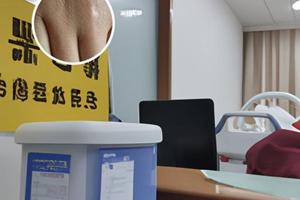 白颠疯扩散是多长时间
