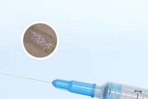 白点癫风好治吗能治疗吗图片和视频