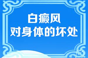 兰州皋兰县治疗白癜风医院哪个比较正规
