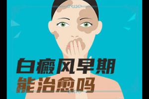 兰州安宁区较好治疗白癜风的医院是哪家