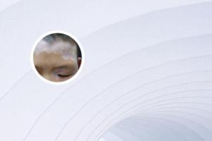 手上长白颠疯病可以治愈吗