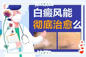 东莞厚街有没有308准分子激光