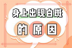 东莞白颠病初期怎么治疗