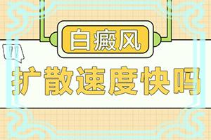 东莞去哪家医院能白癜风