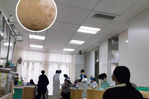 白癫疯病能治好吗要多久