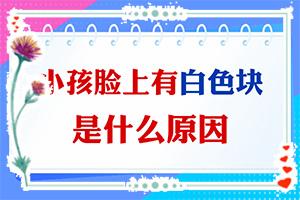东莞看白癜风较好的医院是哪家
