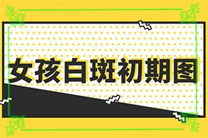 东莞白斑的鉴别-白点癫风的初期图