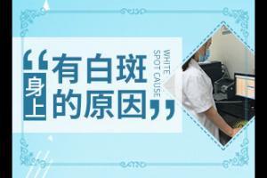 东莞较好的治疗白癜风的医院