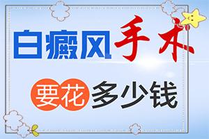 看白癫疯在东莞什么地方-东莞治疗白癜风好的医院