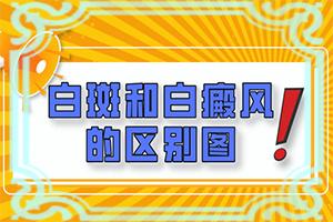东莞专科白癜风医院怎么样