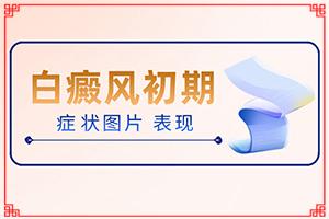 兰州安宁区去哪个白癜风专科医院好