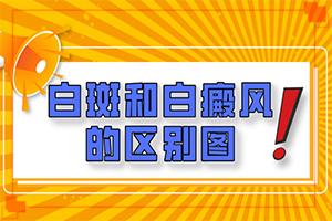 东莞哪个治疗白癜风医院较好