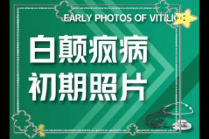 东莞治疗白癜风较好的医院有几家