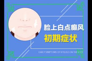 东莞专业的白癜风医院是哪家