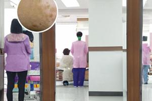 小孩四指是白颠疯能治好吗