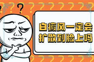 东莞白癜风治疗哪家医院