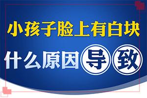 东莞医院哪家治疗白癜风一些