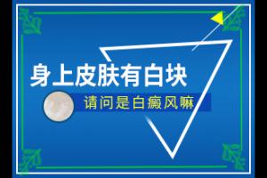 甘肃兰州白癜风专科医院哪家治疗好