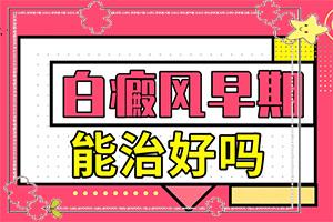 东莞哪家医院是专业治疗白癜风