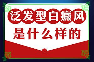 宁夏固原白癜风专科医院较好的是哪家医院