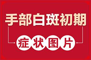 东莞医院是私立医院吗-皮肤白班早期图片