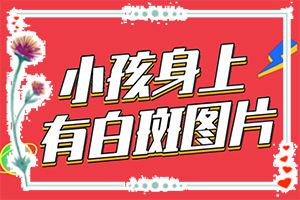 东莞什么医院治疗白癜风较好