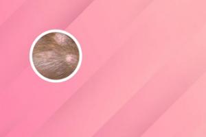 贞芪扶正颗粒增强免疫力效果好吗