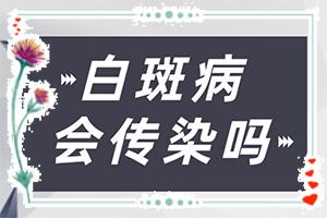 东莞白癜风较好治疗医院-白班早期症状图片
