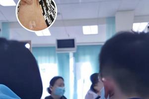 贞芪扶正颗粒有什么不良反应