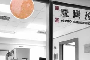 注射用甲泼尼龙琥珀酸钠治啥病