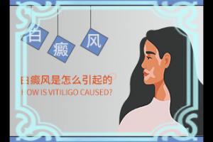 甘肃兰州专科医院治疗白癜风需要多少钱
