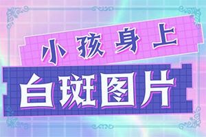 得了白癜风在兰州皋兰县哪所医院治疗好