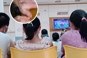 白癜风传统疗法缺点