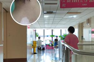 孩子白点癫风是什么原因引起的图片