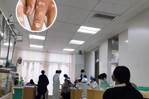 泛发性白斑能控制吗