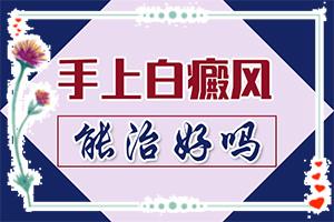 东莞轻度初期白癞风吃什么好的药