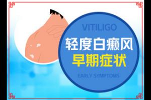 兰州皋兰县白癜风专科医院哪家治疗好