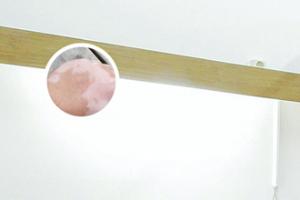孩子3岁白颠风怎么治